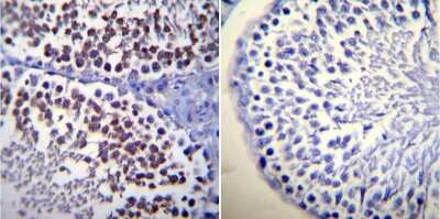 Immunohistochemistry-Paraffin: Calmodulin Antibody (2D1) - BSA Free [NB120-2860]