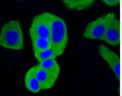 Immunocytochemistry/ Immunofluorescence: Calmodulin Antibody (SJ16-09) [NBP2-67413]
