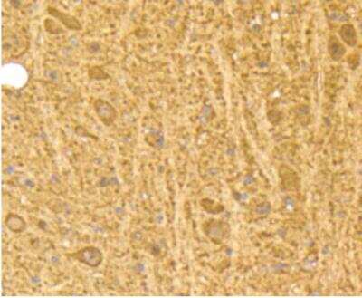 Immunohistochemistry-Paraffin: Calmodulin Antibody (SJ16-09) [NBP2-67413]