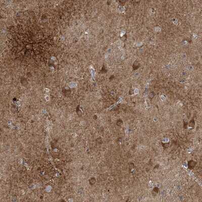 Immunohistochemistry-Paraffin: Calneuron 1 Antibody [NBP1-87422]