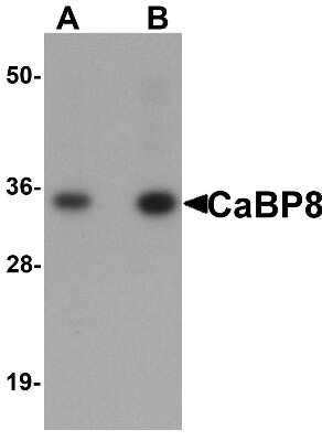 Western Blot: Calneuron 1 AntibodyBSA Free [NBP1-76274]