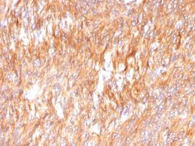 Immunohistochemistry-Paraffin: Calnexin Antibody (CANX/1541) [NBP2-53352]