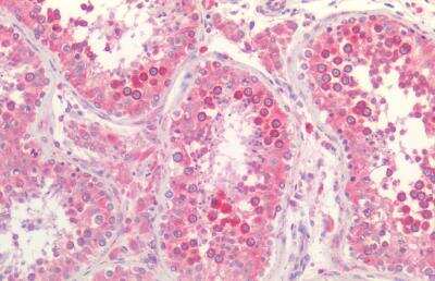 Immunohistochemistry-Paraffin: Calnexin Antibody [NBP1-37774]
