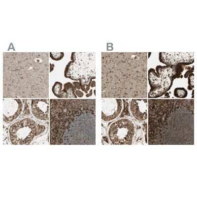 Immunohistochemistry-Paraffin: Calnexin Antibody [NBP1-85519]