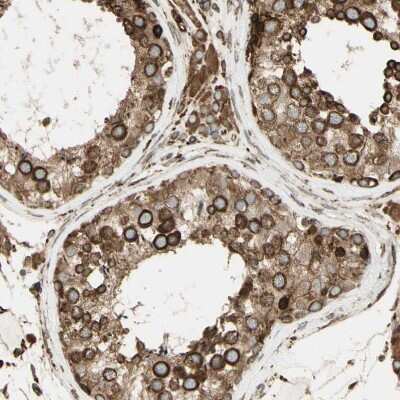 Immunohistochemistry-Paraffin: Calnexin Antibody [NBP1-85519]