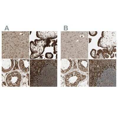Immunohistochemistry-Paraffin: Calnexin Antibody [NBP1-85520]