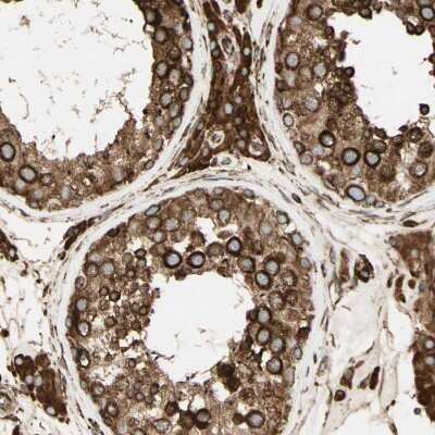 Immunohistochemistry-Paraffin: Calnexin Antibody [NBP1-85520]