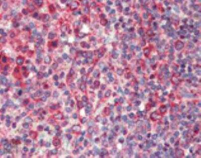 Immunohistochemistry-Paraffin: Calnexin Antibody [NBP1-97485]
