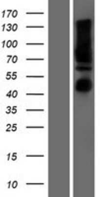 Western Blot: Calnexin Overexpression Lysate [NBP2-10767]