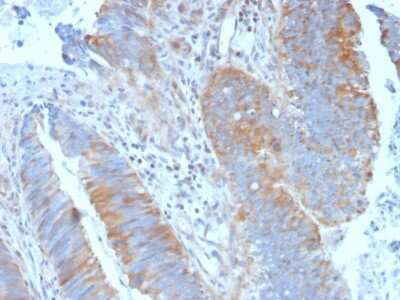 Immunohistochemistry-Paraffin: Calpain 1 Antibody (CAPN1/1530) - Azide and BSA Free [NBP3-08456]