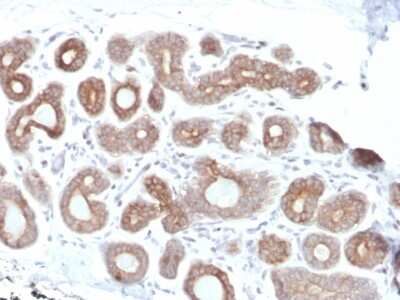 Immunohistochemistry-Paraffin: Calpain 1 Antibody (CAPN1/1530) - Azide and BSA Free [NBP3-08456]