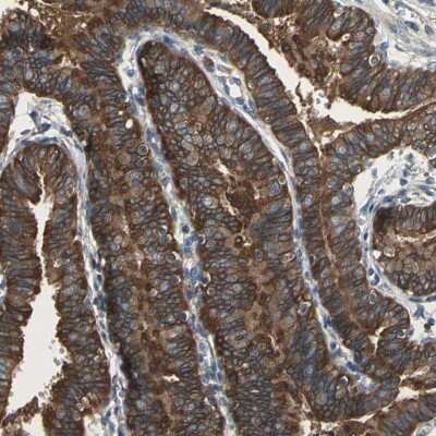 Immunohistochemistry-Paraffin: Calpain 1 Antibody [NBP1-88205]