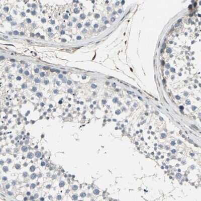 Immunohistochemistry-Paraffin: Calpain 1 Antibody [NBP1-88205]