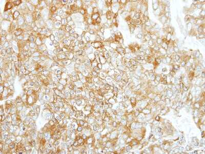 Immunohistochemistry-Paraffin: Calpain 1 Antibody [NBP2-15671]