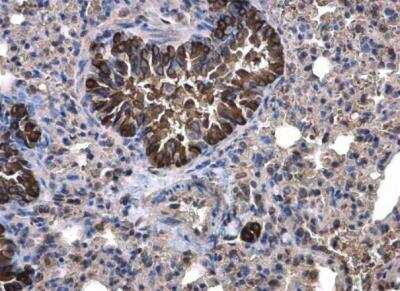 Immunohistochemistry-Paraffin: Calpain 1 Antibody [NBP2-15671]