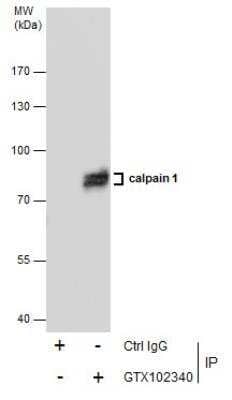 Immunoprecipitation: Calpain 1 Antibody [NBP2-15671]
