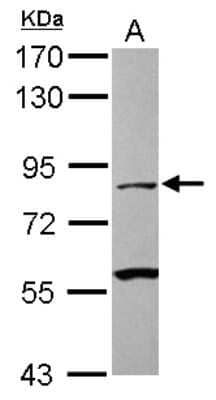 Western Blot: Calpain 1 Antibody [NBP2-15670]