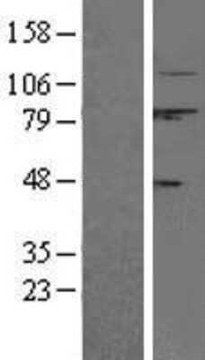 Western Blot: Calpain 1 Overexpression Lysate [NBL1-08677]