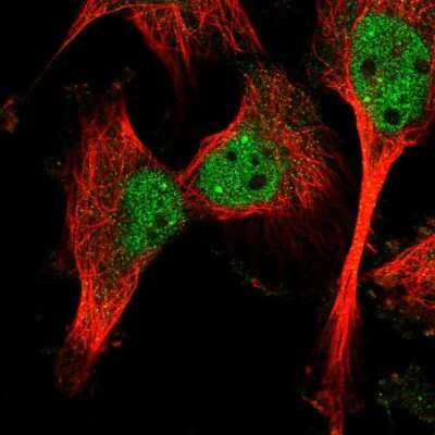 Immunocytochemistry/ Immunofluorescence: Calpain 10 Antibody [NBP2-55051]