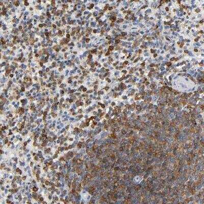 Immunohistochemistry: Calpain 10 Antibody [NBP1-87489]