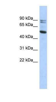 Western Blot: Calpain 10 Antibody [NBP1-53117]