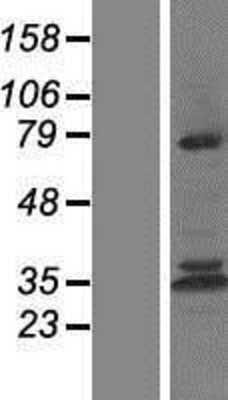 Western Blot: Calpain 10 Overexpression Lysate [NBP2-06390]