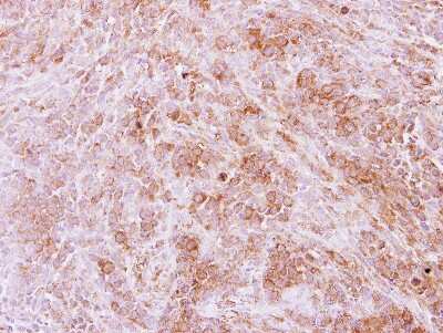Immunohistochemistry-Paraffin: Calpain 11 Antibody [NBP2-15673]