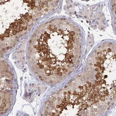 Immunohistochemistry-Paraffin: Calpain 11 Antibody [NBP2-33942]