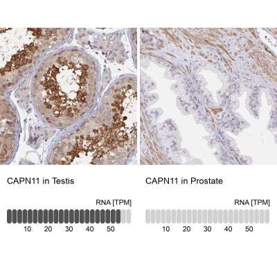 Immunohistochemistry-Paraffin: Calpain 11 Antibody [NBP2-33942]