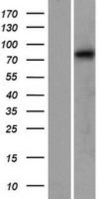 Western Blot: Calpain 12 Overexpression Lysate [NBP2-05538]