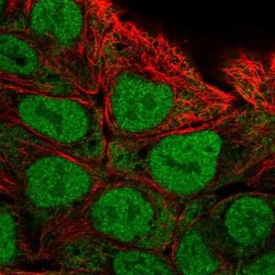 Immunocytochemistry/ Immunofluorescence: Calpain 13 Antibody [NBP2-56669]