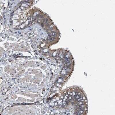 Immunohistochemistry-Paraffin: Calpain 13 Antibody [NBP2-14435]