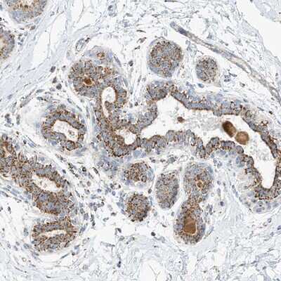 Immunohistochemistry-Paraffin: Calpain 13 Antibody [NBP2-33920]