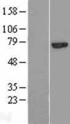 Western Blot: Calpain 13 Overexpression Lysate [NBP2-05560]