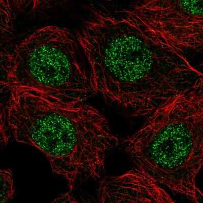 Immunocytochemistry/ Immunofluorescence: Calpain 15 Antibody [NBP1-88197]