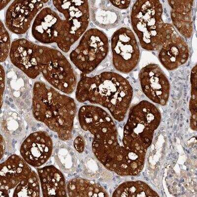 Immunohistochemistry: Calpain 15 Antibody [NBP1-88197]