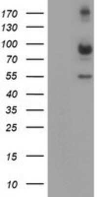 Western Blot: Calpain 2 Antibody (OTI1F4) [NBP2-01814]