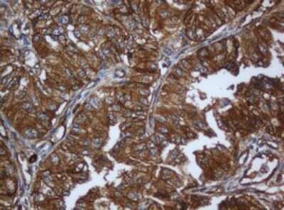 Immunohistochemistry: Calpain 2 Antibody (OTI3G1) [NBP2-46063]