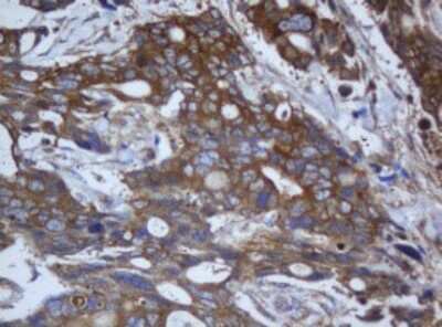 Immunohistochemistry: Calpain 2 Antibody (OTI3G1) [NBP2-46063]