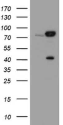 Western Blot: Calpain 2 Antibody (OTI3G1) [NBP2-46063]