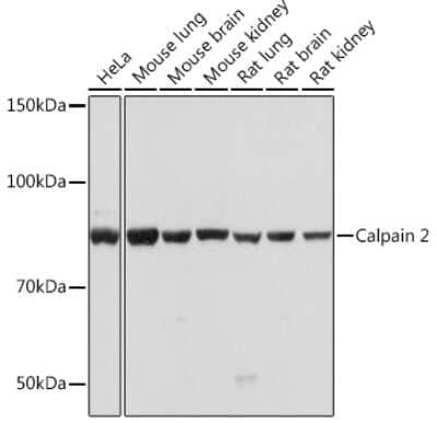 Western Blot: Calpain 2 Antibody (9Y7I1) [NBP3-16324]