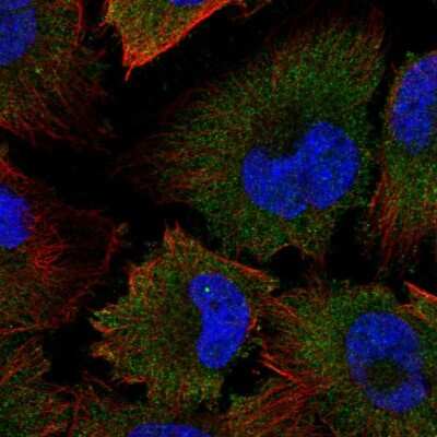 Immunocytochemistry/ Immunofluorescence: Calpain 2 Antibody [NBP1-88204]
