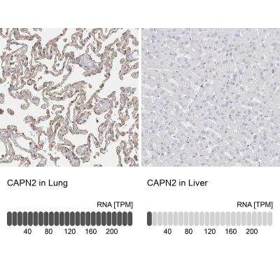 Immunohistochemistry-Paraffin: Calpain 2 Antibody [NBP1-88204]