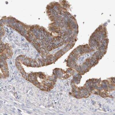 Immunohistochemistry-Paraffin: Calpain 2 Antibody [NBP1-88204]