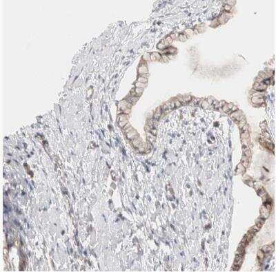 Immunohistochemistry-Paraffin: Calpain 2 Antibody [NBP1-88204]