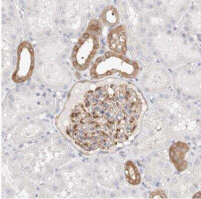 Immunohistochemistry-Paraffin: Calpain 2 Antibody [NBP1-88204]