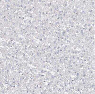 Immunohistochemistry-Paraffin: Calpain 2 Antibody [NBP1-88204]