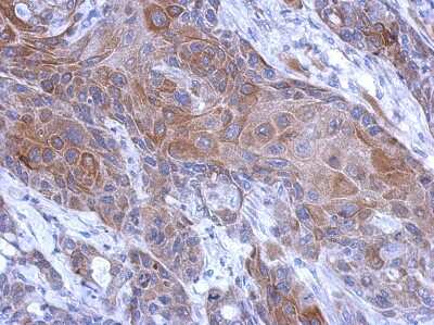 Immunohistochemistry-Paraffin: Calpain 2 Antibody [NBP2-15676]