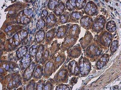 Immunohistochemistry-Paraffin: Calpain 2 Antibody [NBP2-15676]