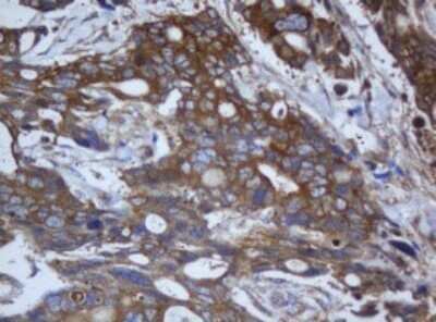 Immunohistochemistry: Calpain 2 Antibody (OTI3G1) - Azide and BSA Free [NBP2-70334]